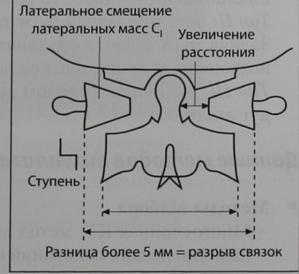 Снимки МРТ и КТ. Перелом Джефферсона